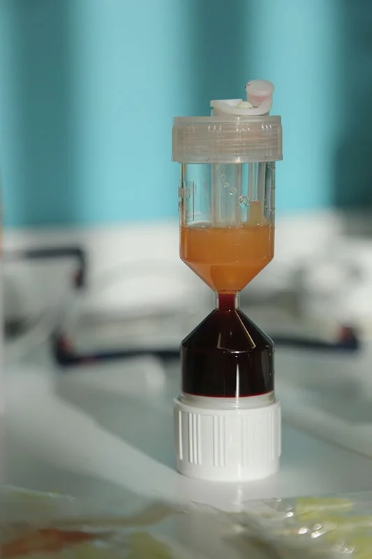 WorldPRP platelet-rich plasma preparation system